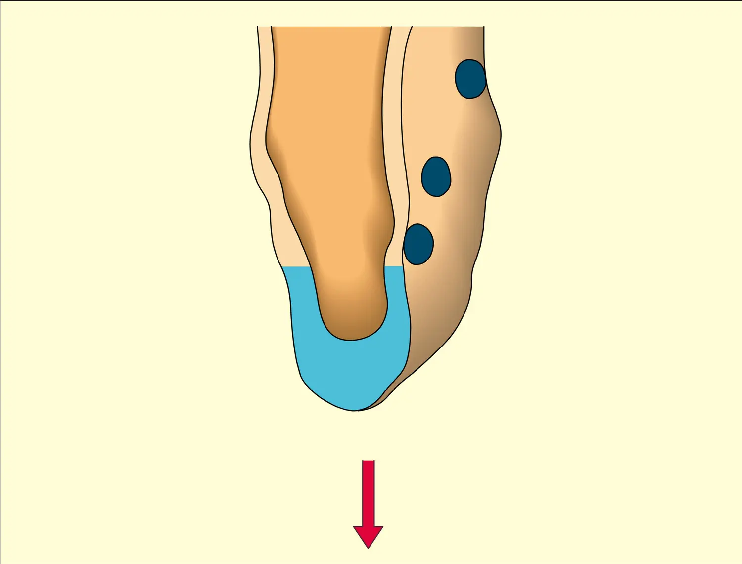 Gouttelettes lipidiques - vue 2