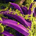 Bacilles de la peste sur des cellules de tube digestif d’une puce - crédits : National Institute of Allergy and Infectious Diseases ; CC0