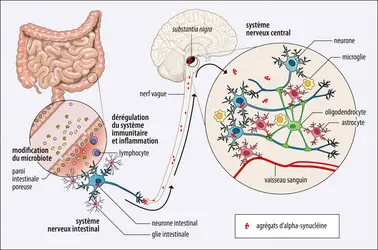 Lien possible entre inflammation intestinale et maladie de Parkinson - crédits : Encyclopædia Universalis France