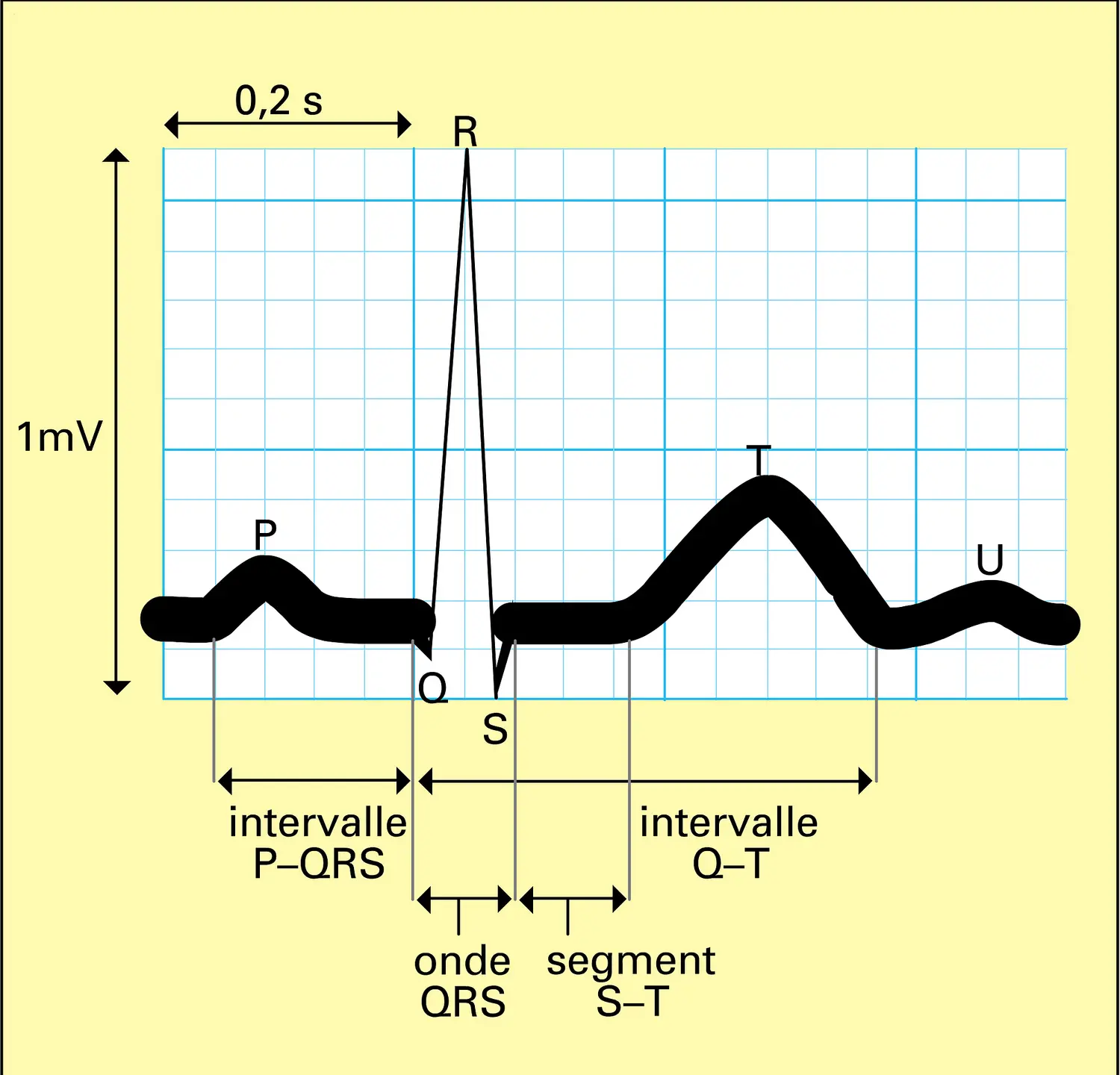 Tracé électrocardiographique normal