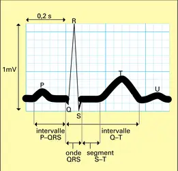 Tracé électrocardiographique normal - crédits : Encyclopædia Universalis France