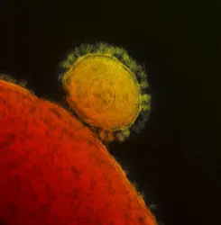Virus du MERS - crédits : NIAID