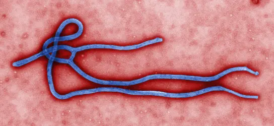 Ebolavirus
 - crédits : C. Goldsmith/ CDC