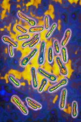 Bacille botulique - crédits : BSIP/ Universal Images Group/ Getty Images