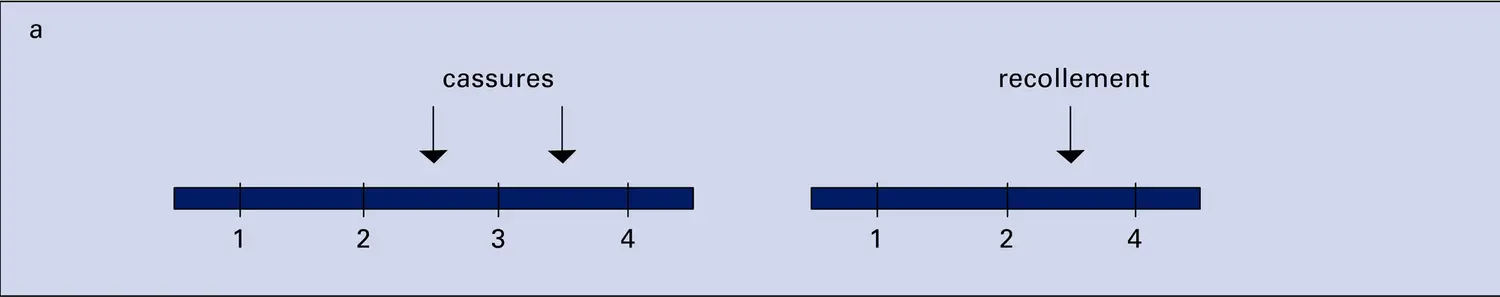 Remaniements chromosomiques - vue 1