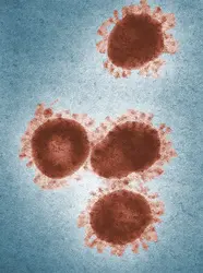 Virus du SRAS - crédits : Dr F. Murphy, S. Whitfield/ CDC