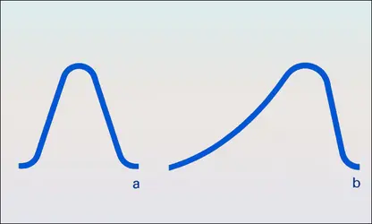 Onde de grande intensité : propagation - crédits : Encyclopædia Universalis France