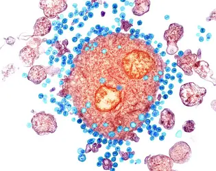 Virus VIH et lymphocyte T4 - crédits : SPL/ AKG-images