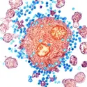 Virus VIH et lymphocyte T4 - crédits : SPL/ AKG-images