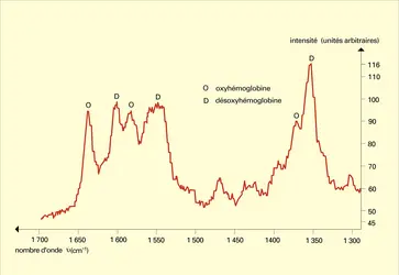 Spectre Raman : cellule sanguine isolée - crédits : Encyclopædia Universalis France