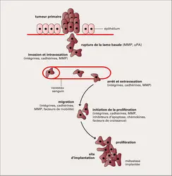Métastases : étapes essentielles - crédits : Encyclopædia Universalis France