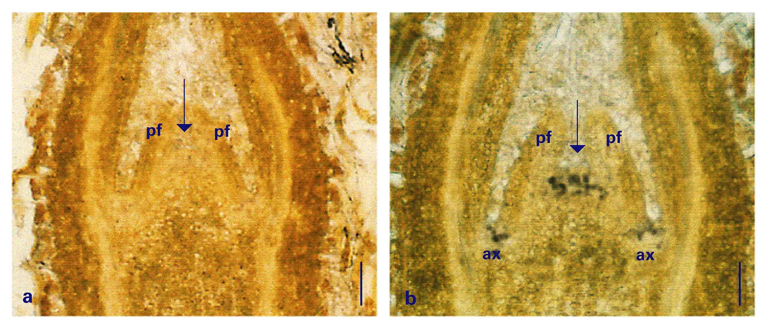 Immunolocalisation in situ