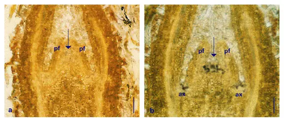 Immunolocalisation in situ - crédits : Encyclopædia Universalis France