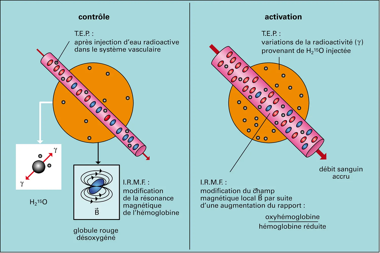 Imagerie cérébrale en T.E.P. et I.R.M.