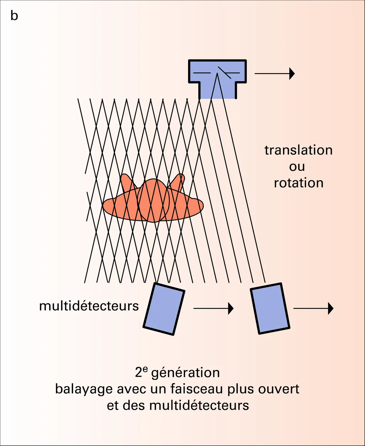 Tomodensitométrie : différents types de systèmes - vue 2