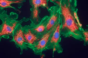 Cellules de tissu conjonctif (fibroblastes) - crédits : Heiti Paves/ Shutterstock