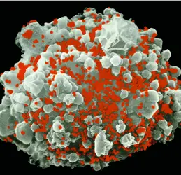 Cellule infectée par le sida - crédits : Science Photo Library/ AKG-images