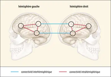 Schématisation de la connectivité intra- et interhémisphérique dans le cerveau - crédits : Encyclopædia Universalis France
