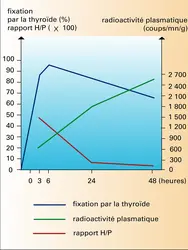 Test à l'iode 131 : maladie de Basedow - crédits : Encyclopædia Universalis France