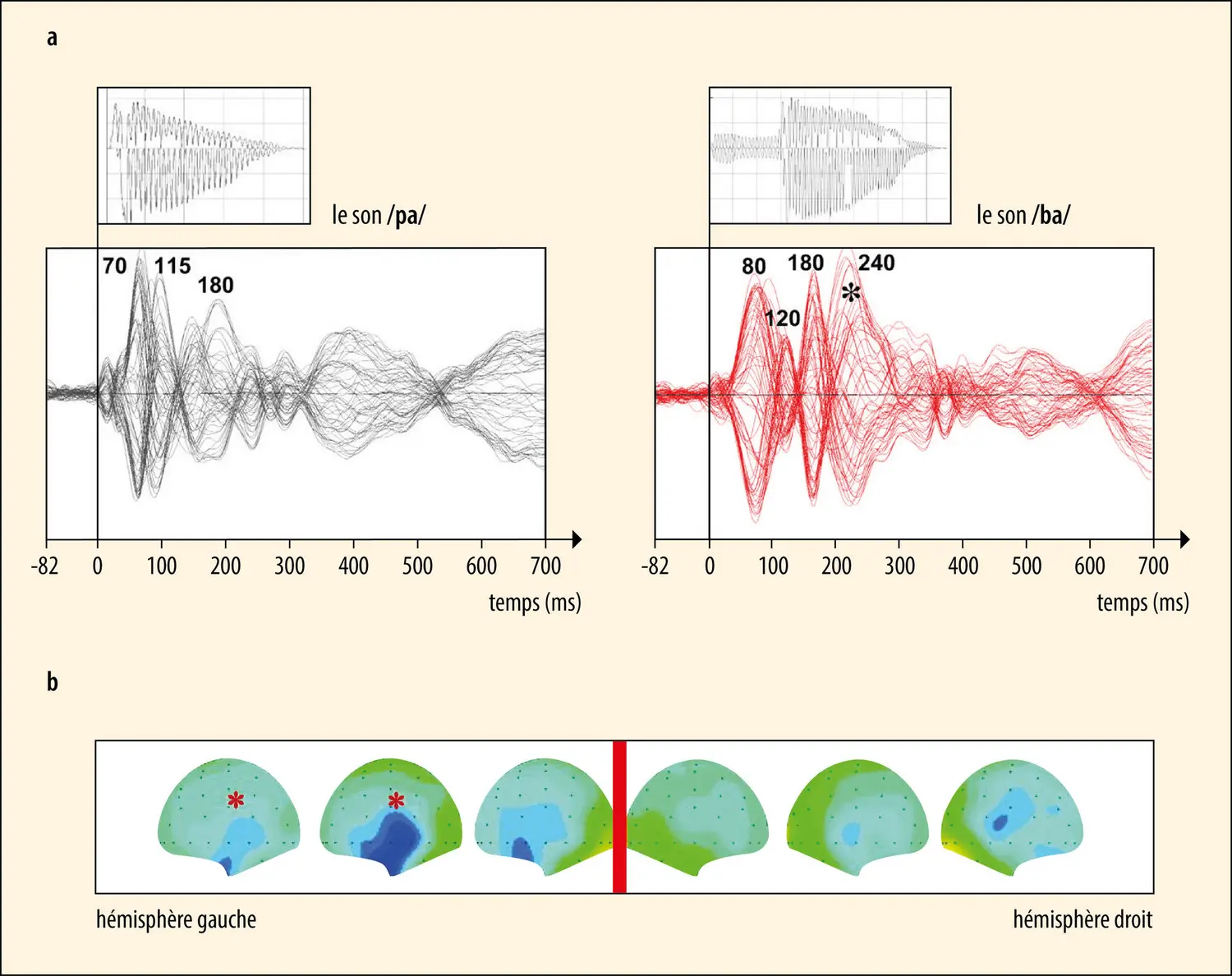 Décours temporel des ondes électriques cérébrales impliquées dans le codage de la parole