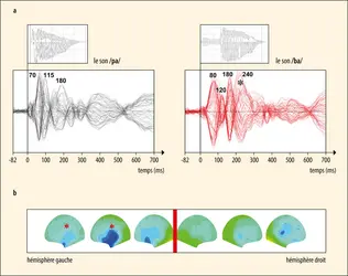 Décours temporel des ondes électriques cérébrales impliquées dans le codage de la parole - crédits : Encyclopædia Universalis France