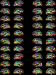 Cerveau et langage, un fonctionnement en réseau - crédits : 2016 Vassal et al. PLoS ONE 11(3): e0152614 (CC BY 4.0)