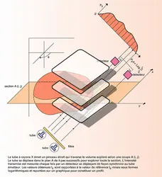 Tomodensitométrie : projection et balayage - crédits : Encyclopædia Universalis France