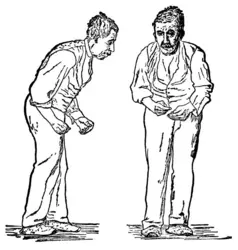 Syndromes parkinsoniens 
 - crédits : D'après W. R. Gowers, A Manual of Diseases of the Nervous System,1886