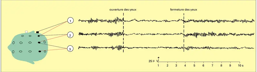 Électroencéphalographie : réaction d'arrêt de Berger - crédits : Encyclopædia Universalis France