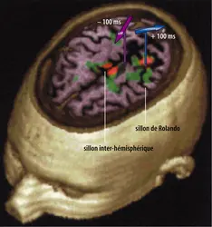 Imagerie cérébrale multimodale - crédits : Encyclopædia Universalis France