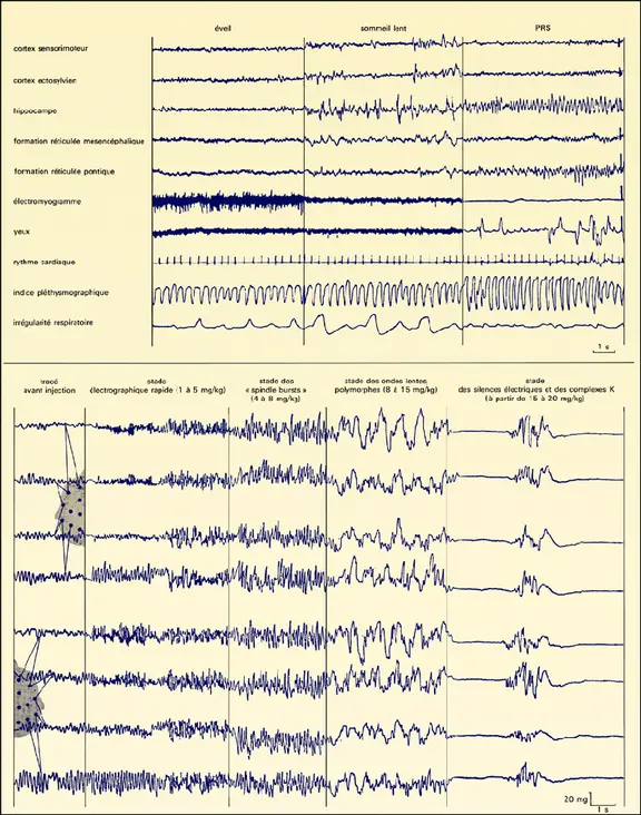 Sommeils physiologique et anesthésique