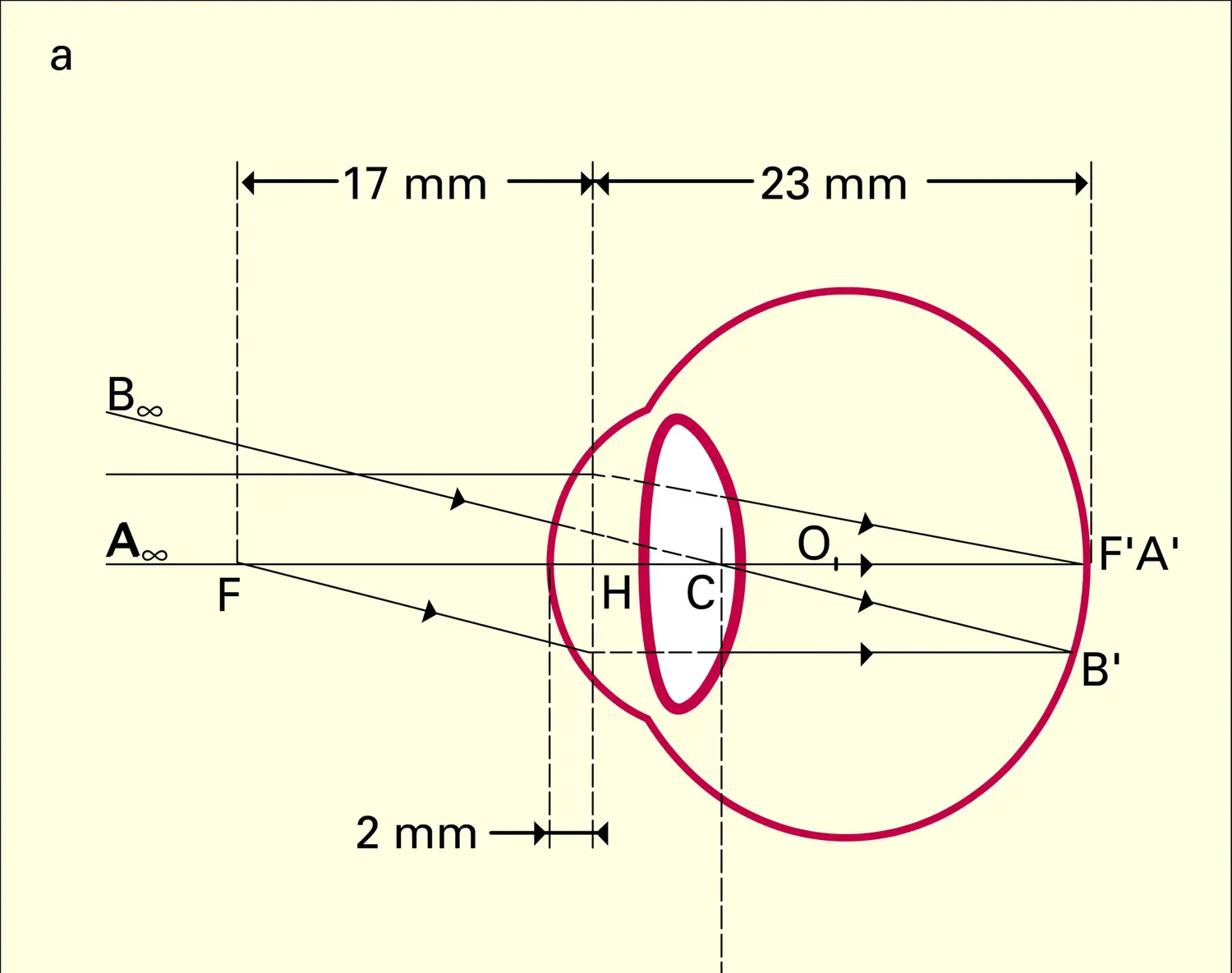 Formation des images : bonne et mauvaise vues - vue 1