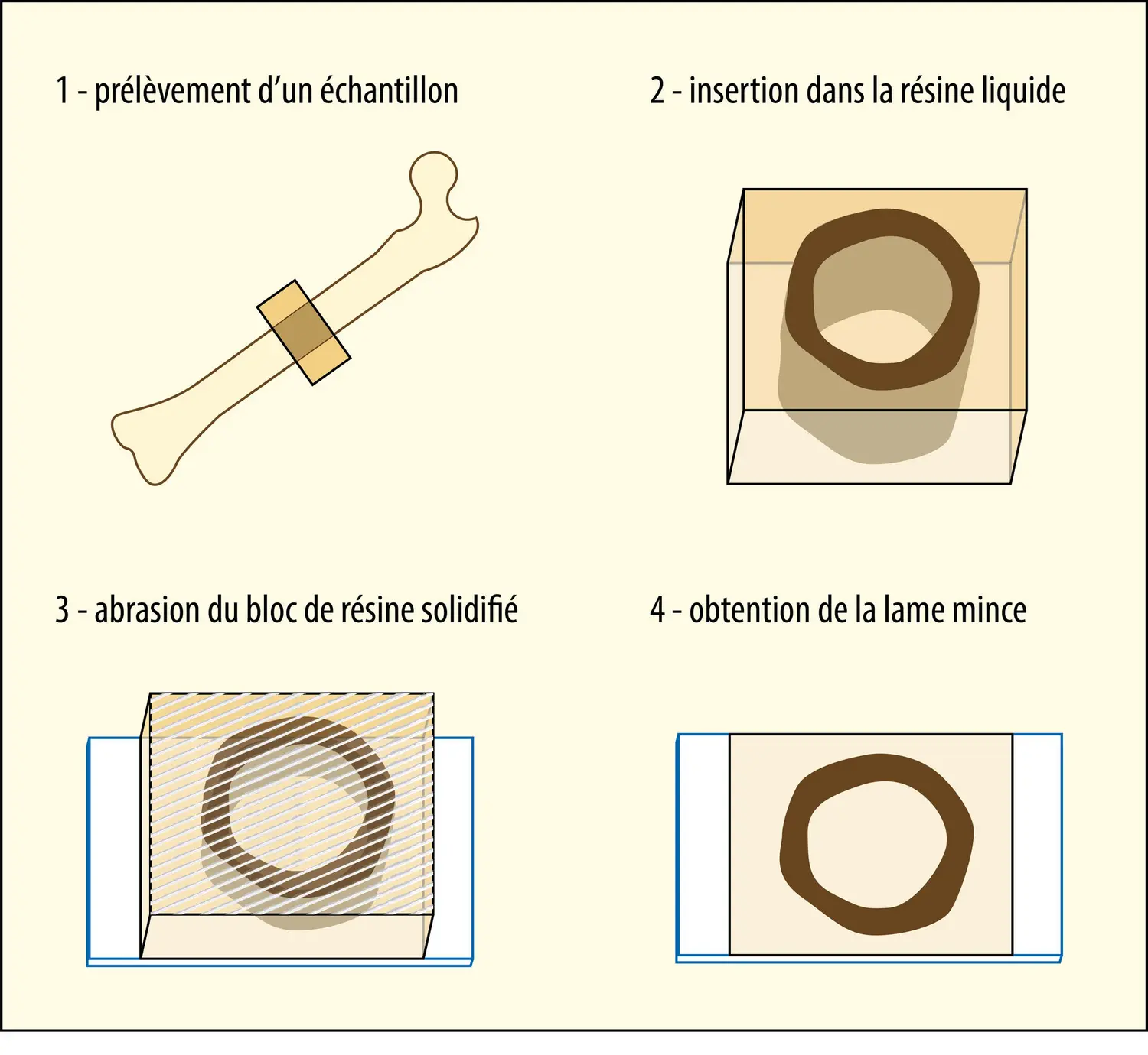 Élaboration d’une lame mince en histologie et paléohistologie