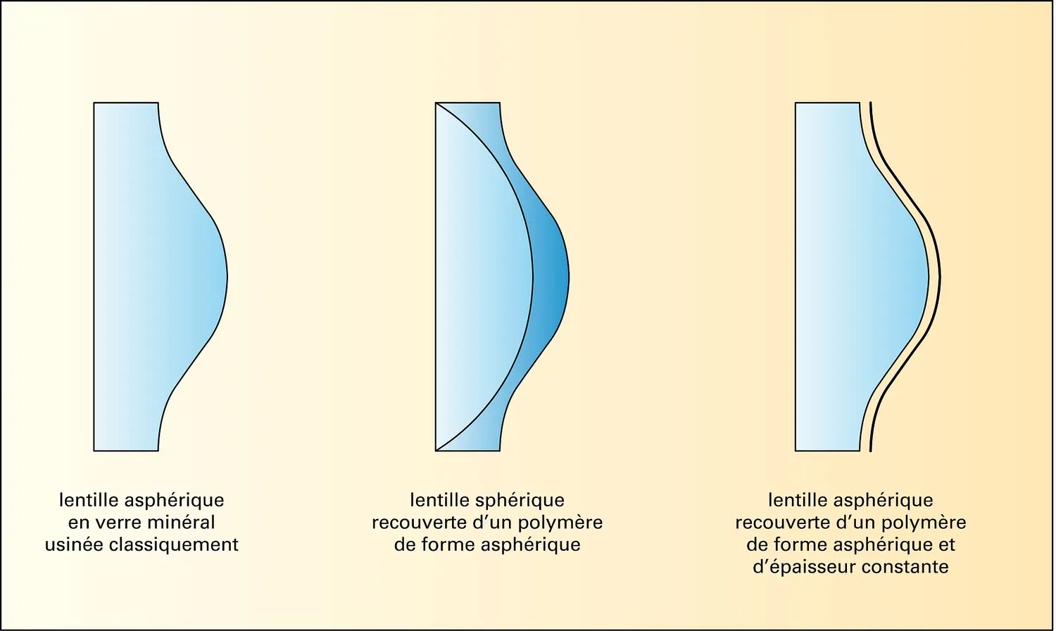 Objectif photographique : lentilles asphériques