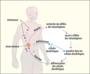 Schéma thérapeutique d’une vaccination anticancer - crédits : Encyclopædia Universalis France