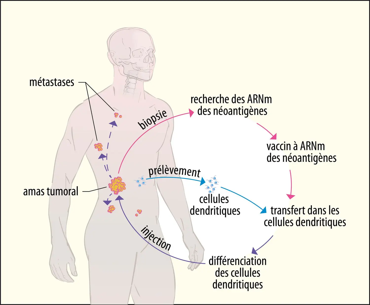 Schéma thérapeutique d’une vaccination anticancer