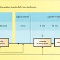 Évolution de la syphilis acquise non traitée - crédits : Encyclopædia Universalis France