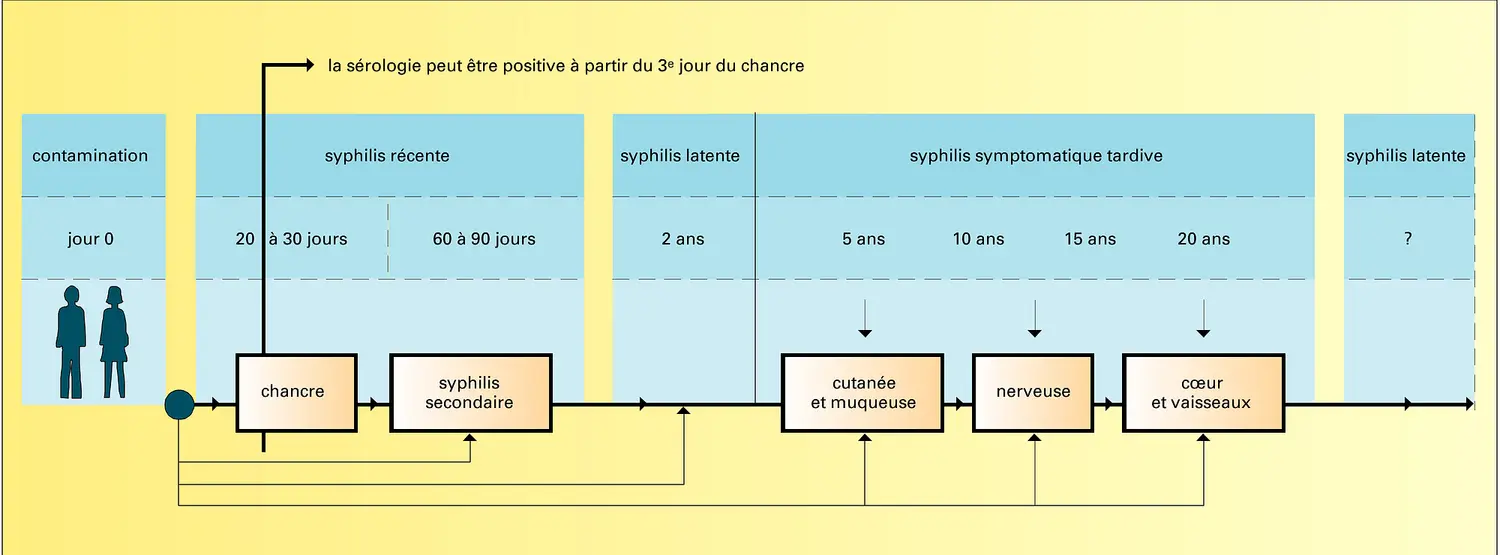 Évolution de la syphilis acquise non traitée