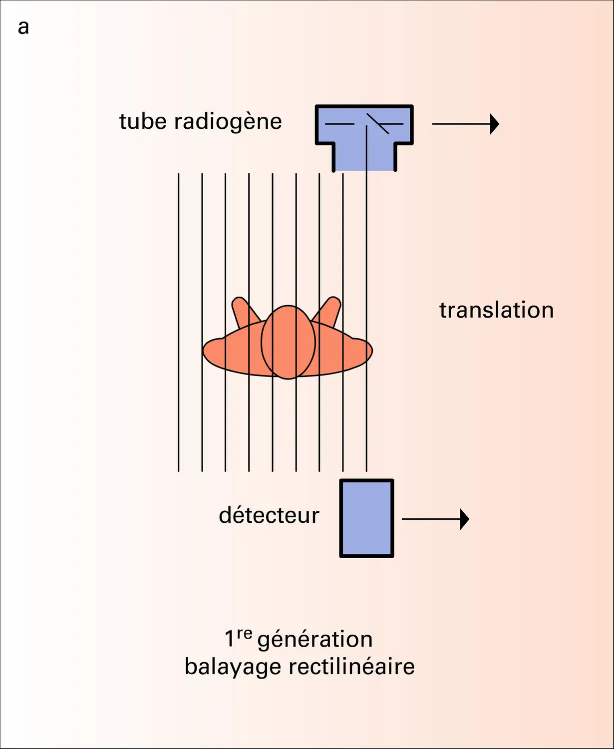 Tomodensitométrie : différents types de systèmes - vue 1