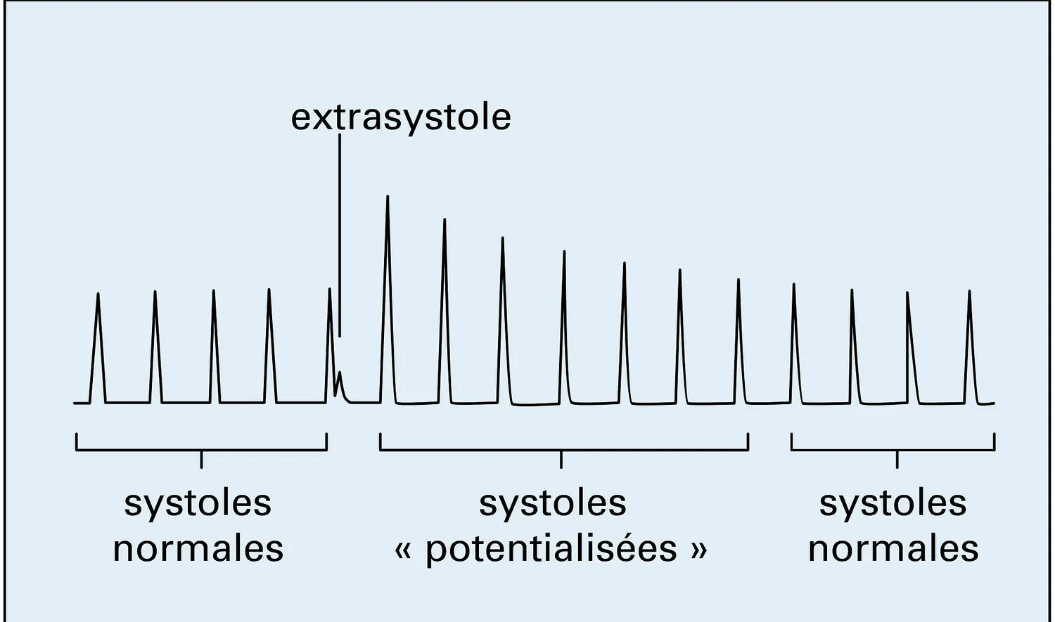 Contractions cardiaques lors d'une potentiation post-extrasystolique