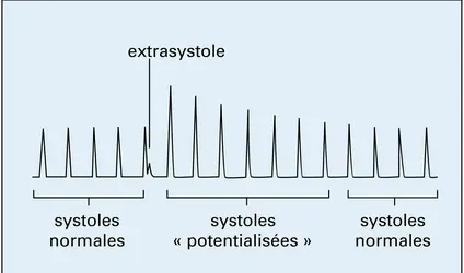 Contractions cardiaques lors d'une potentiation post-extrasystolique - crédits : Encyclopædia Universalis France