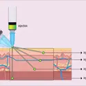 Sites d’injection - crédits : Encyclopædia Universalis France