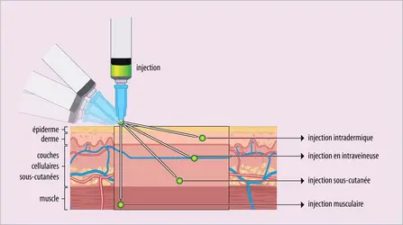 Sites d’injection - crédits : Encyclopædia Universalis France