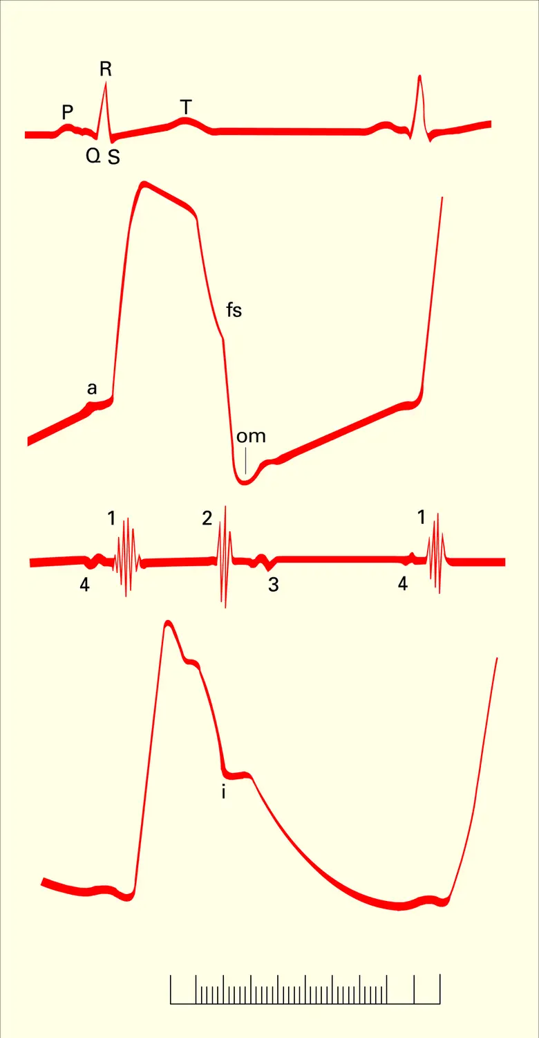 Activité cardiaque - vue 1