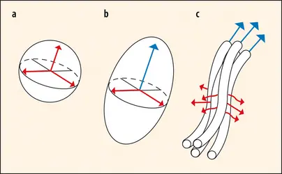 Principe de l’IRM de diffusion - crédits : Encyclopædia Universalis France