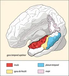 Les aires du cortex cérébral impliquées dans la perception de la parole - crédits : Encyclopædia Universalis France