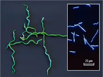 <em>Borrelia burgdorferi</em> - crédits : à gauche : eye of Science/ SPL France; à droite : Université de Strasbourg, centre national de référence des Borrélia