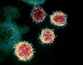 Virus SARS-CoV-2, responsable de la pandémie de Covid-19 - crédits : NIAID-RML