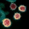 Virus SARS-CoV-2, responsable de la pandémie de Covid-19 - crédits : NIAID-RML