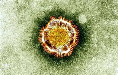 Coronavirus MERS - crédits : Associated Press/ Health Protection Agency
